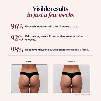 3D Anti-Cellulite Legging