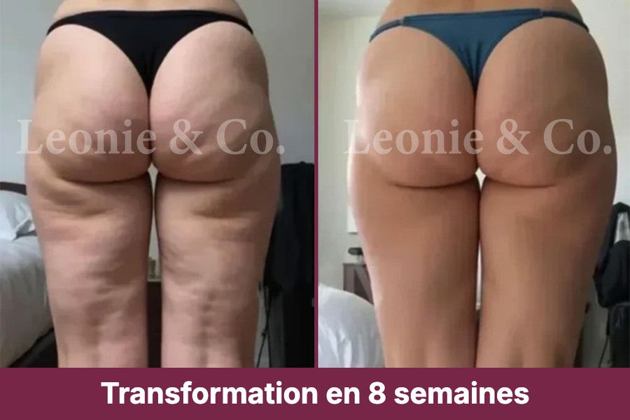 Emma (38 ans)