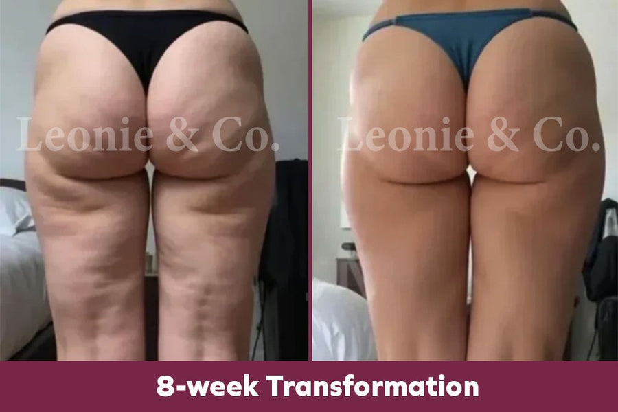 Emma (38 yrs)