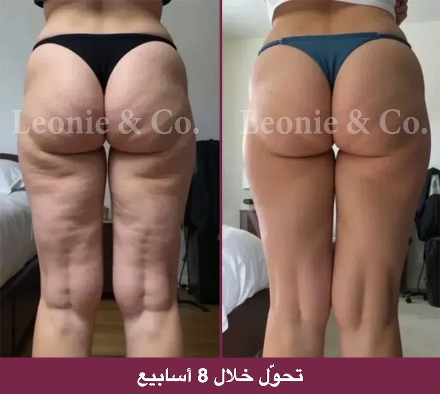 Emma (38 عامًا)