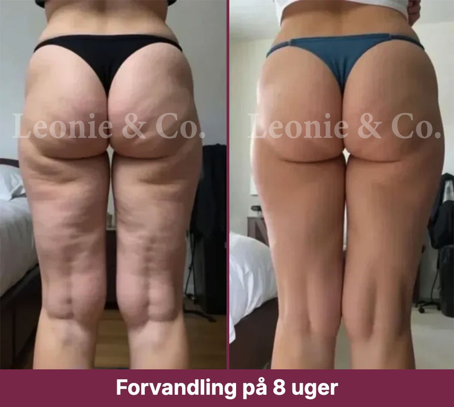 Emma (38 år)