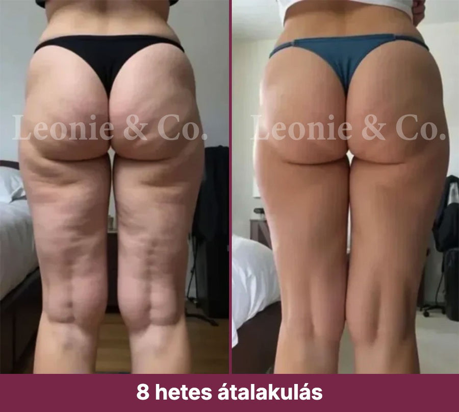 Emma (38 éves)