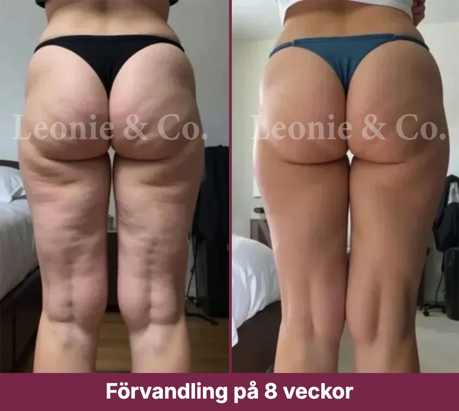 Emma (38 år)