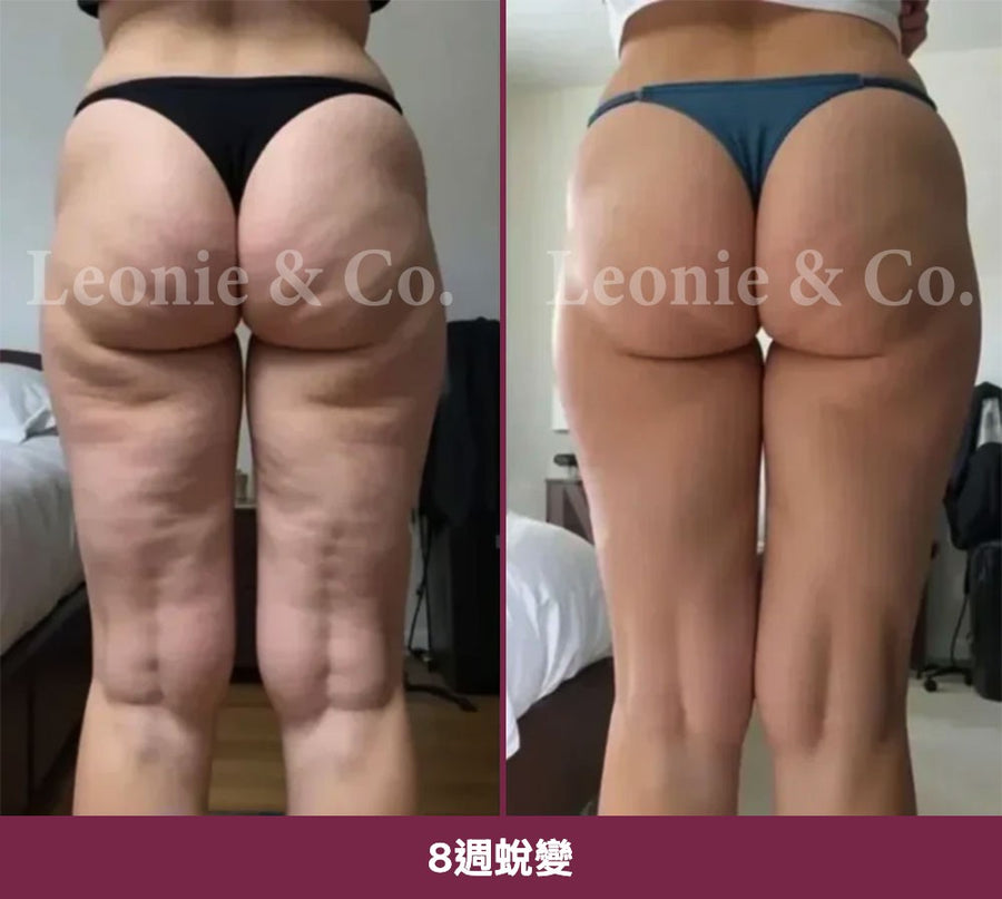 Emma（38 歲）