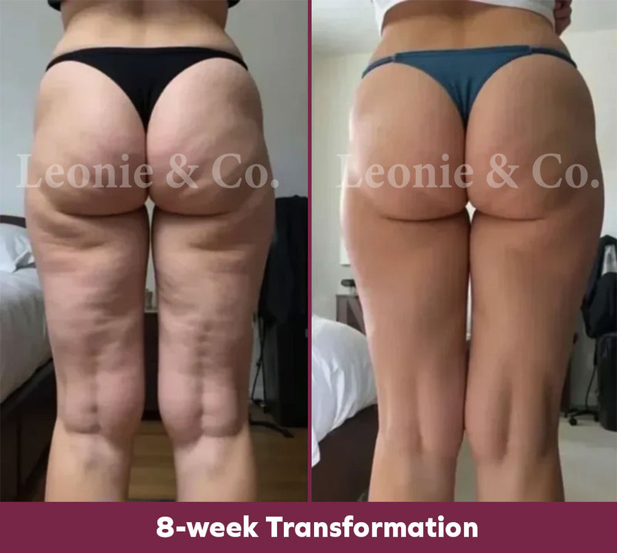 Emma (38 yrs)