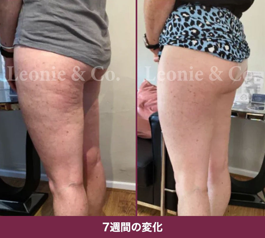 Claire（43歳）