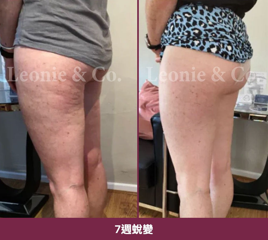 Claire（43 歲）