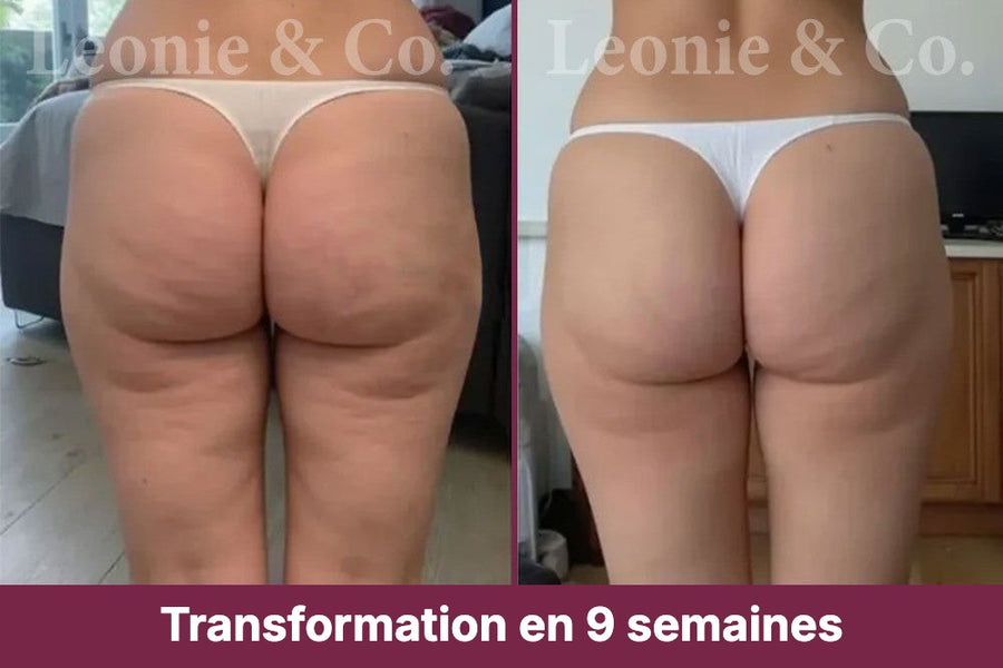 Hannah (31 ans)