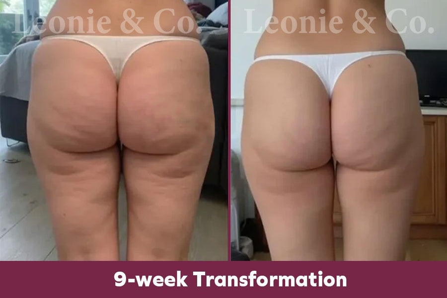 Hannah (31 yrs)