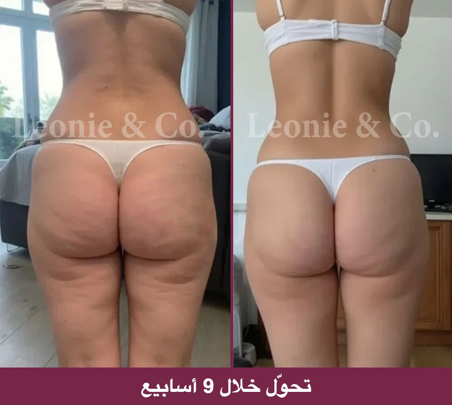 Hannah (31 عامًا)