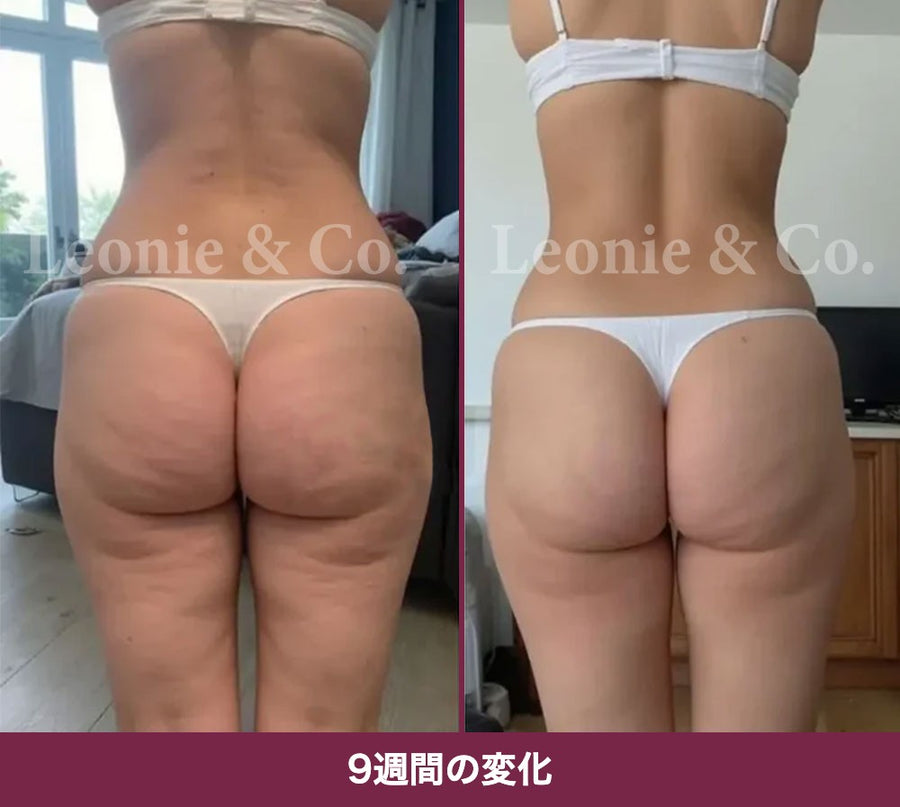 Hannah（31歳）