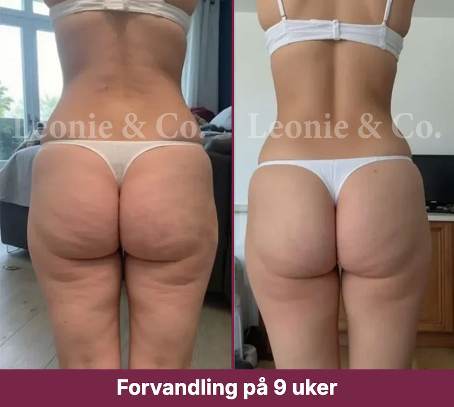 Hannah (31 år)