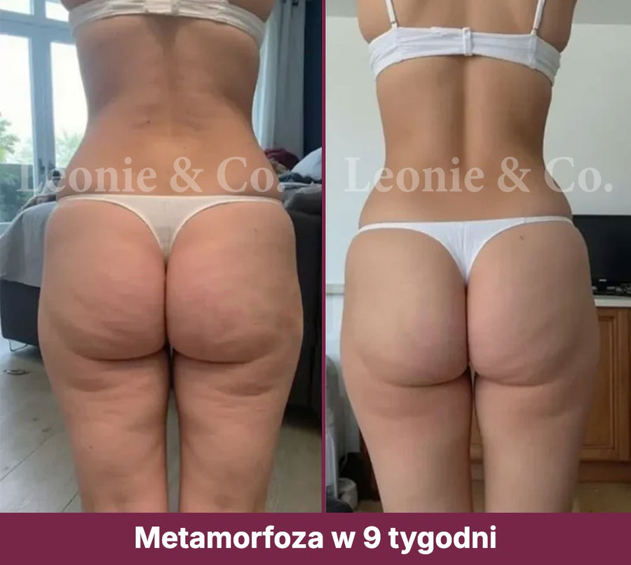 Hannah (31 lat)