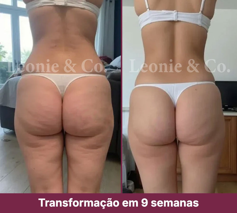 Hannah (31 anos)