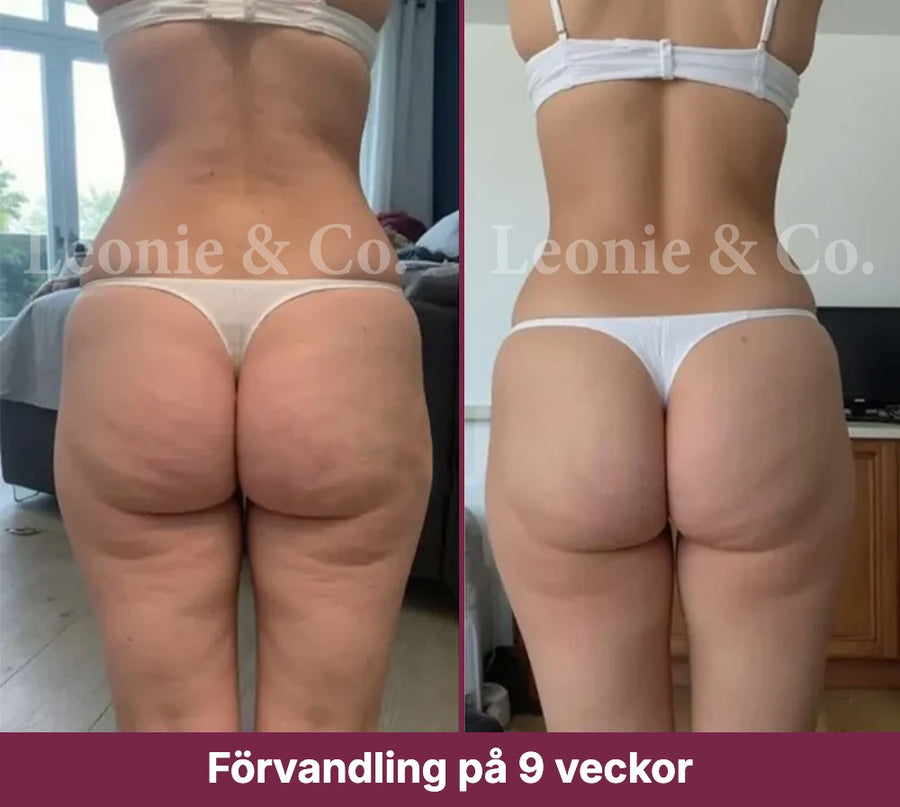 Hannah (31 år)