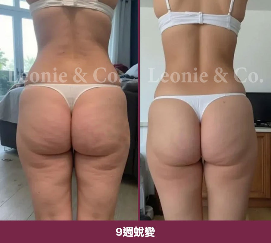 Hannah（31 歲）