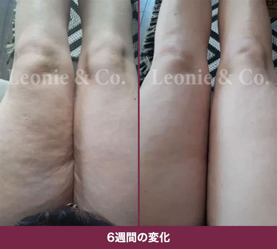Charlotte（36歳）