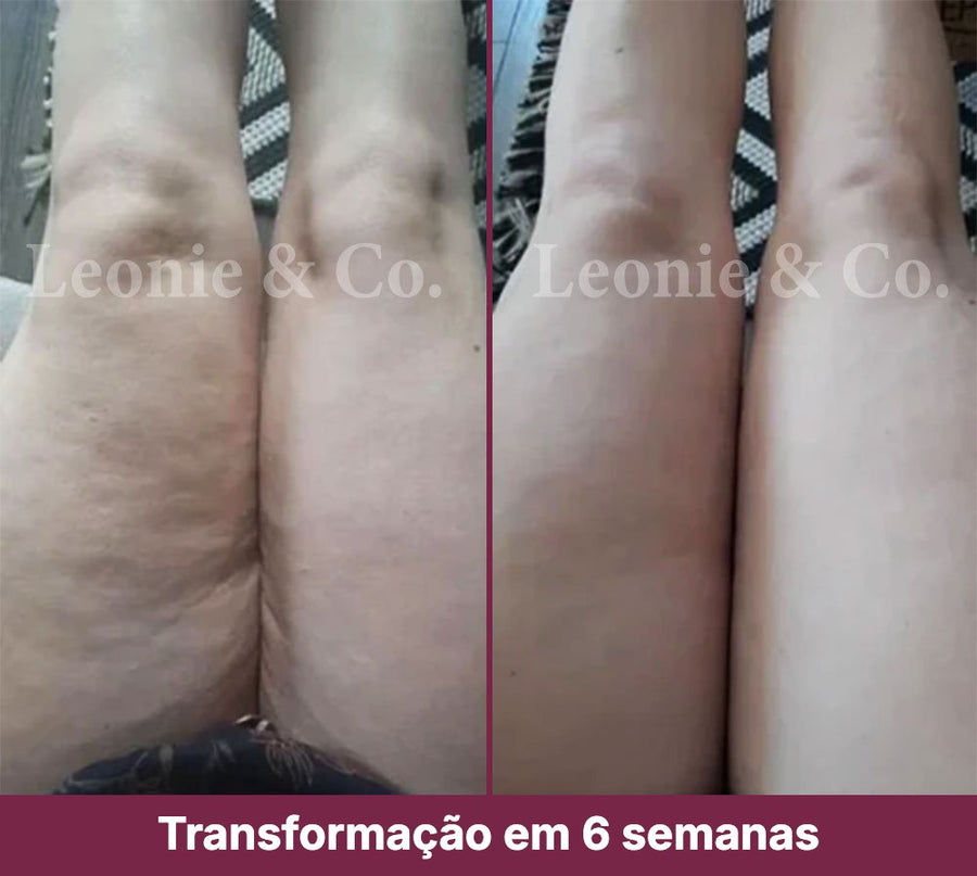 Charlotte (36 anos)