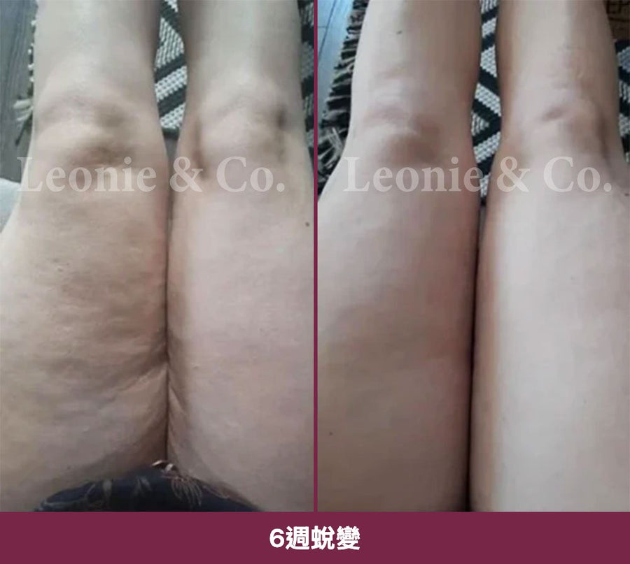 Charlotte（36 歲）