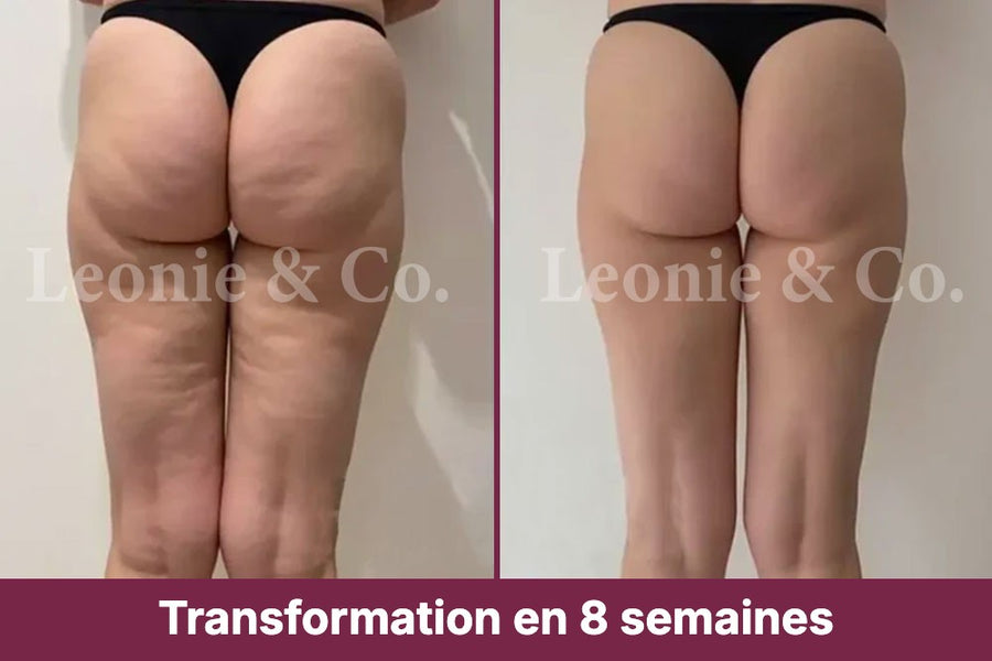 Sophie (41 ans)