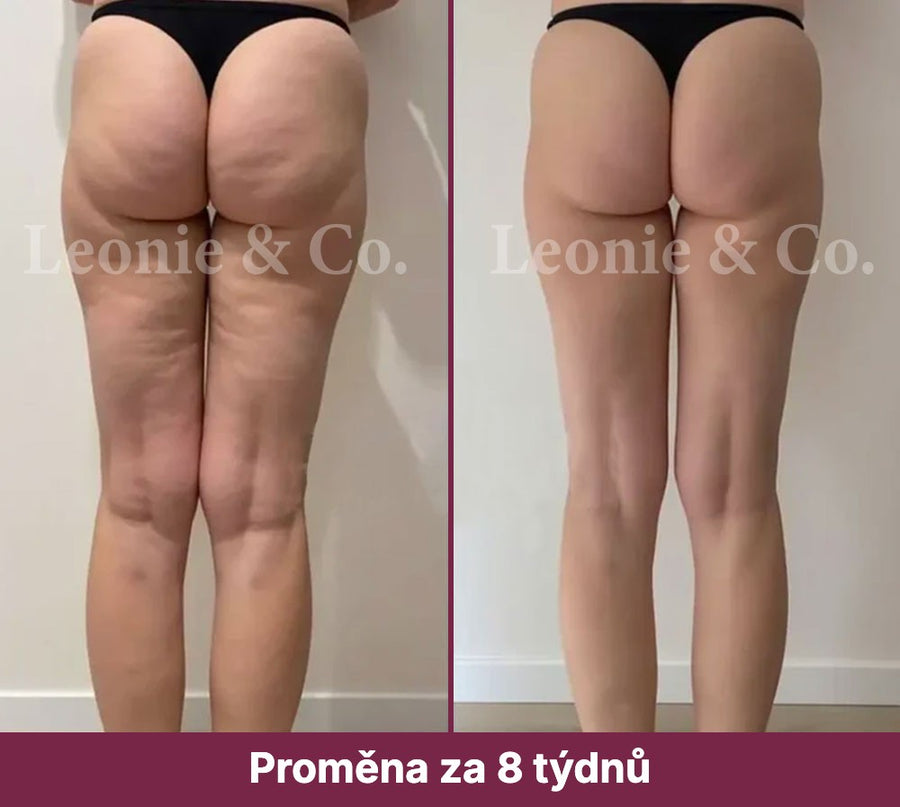 Sophie (41 let)