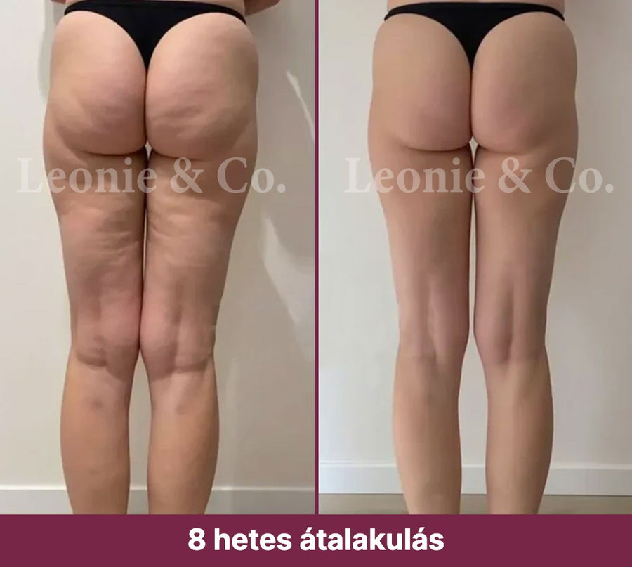 Sophie (41 éves)