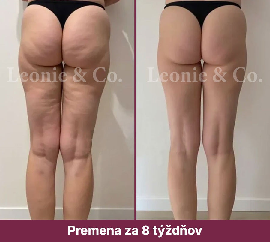 Sophie (41 rokov)