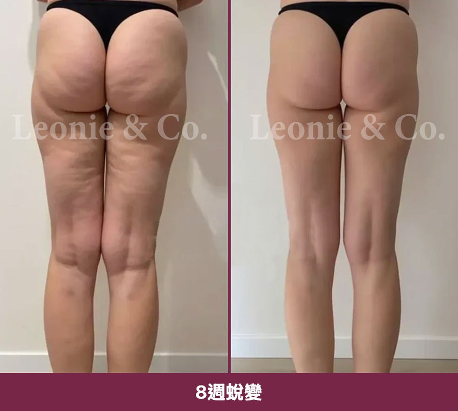 Sophie（41 歲）