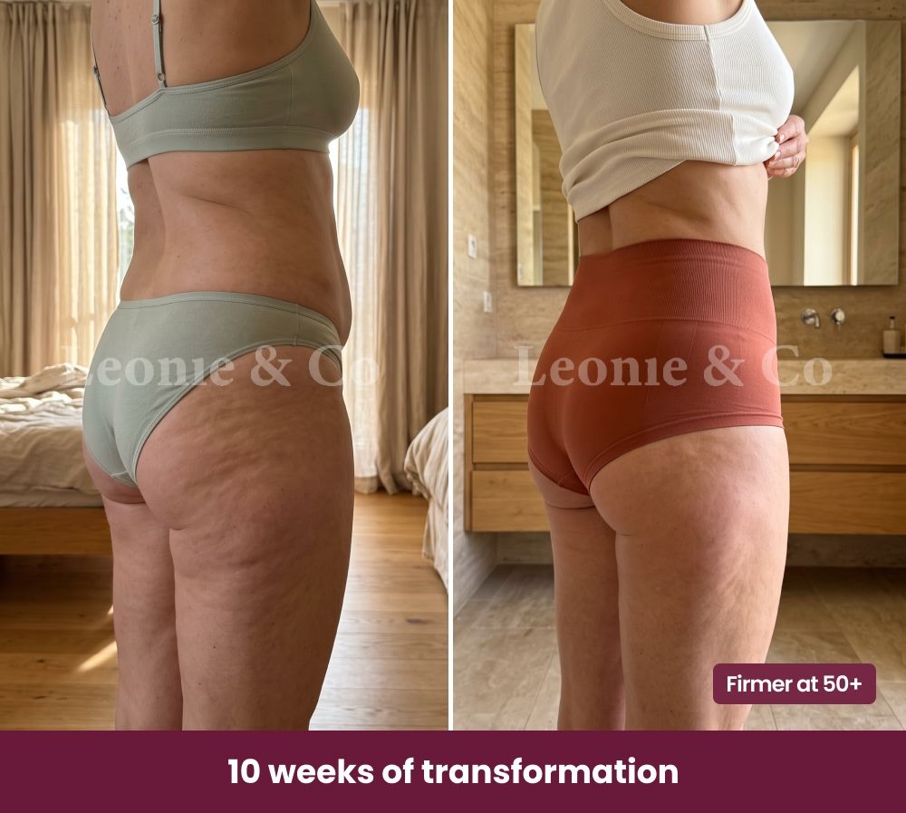 Before & After Emma (38 years old)