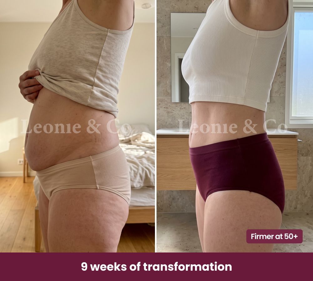 Before & After Hannah (31 years old)