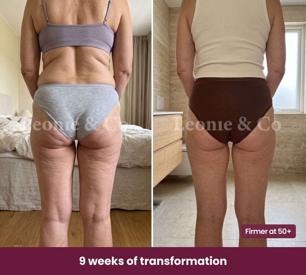 Before & After Charlotte (36 years old)