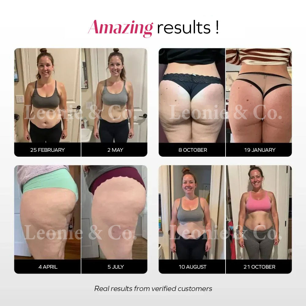 3D Anti-Cellulite Legging