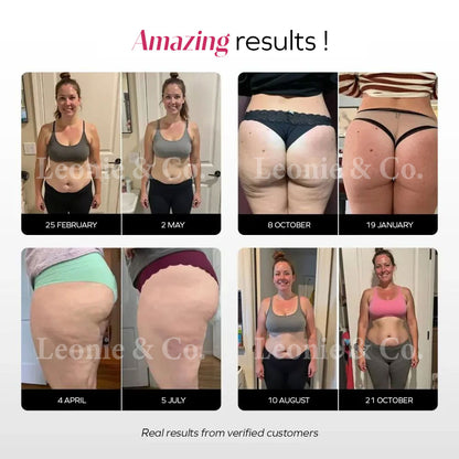 3D Anti-Cellulite Legging