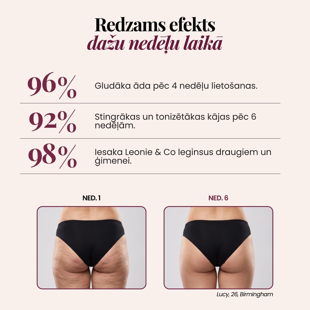 3D legingi | Melna