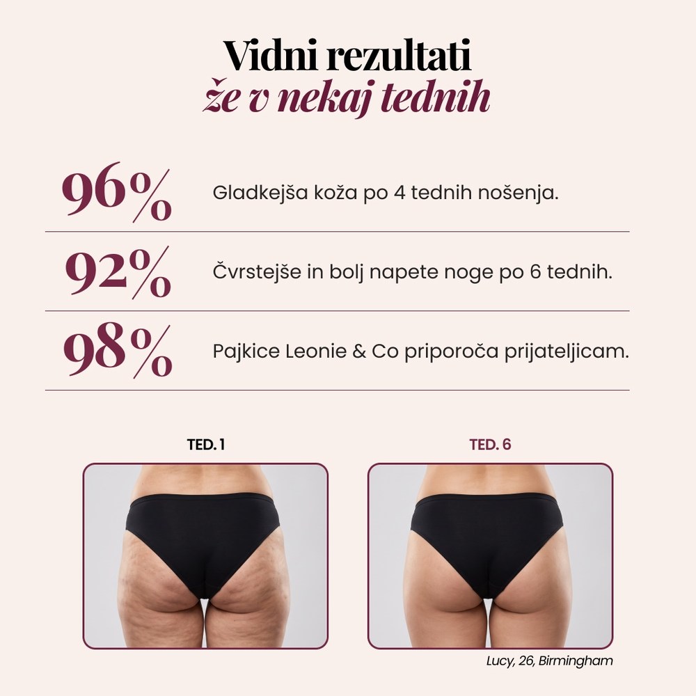 3D pajkice | Črna