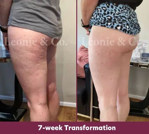 Customer before and after, 8 weeks
