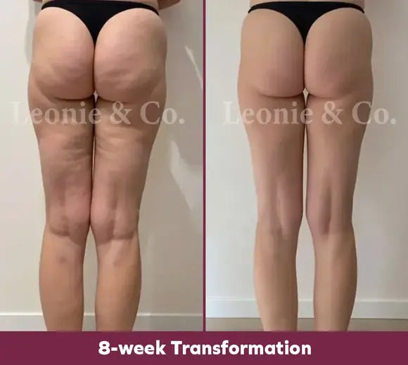 Customer before and after, 8 weeks