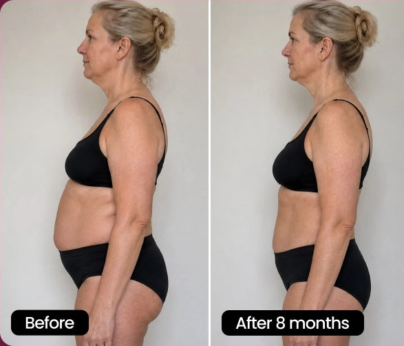 Bafore & After Claire (43 years old)