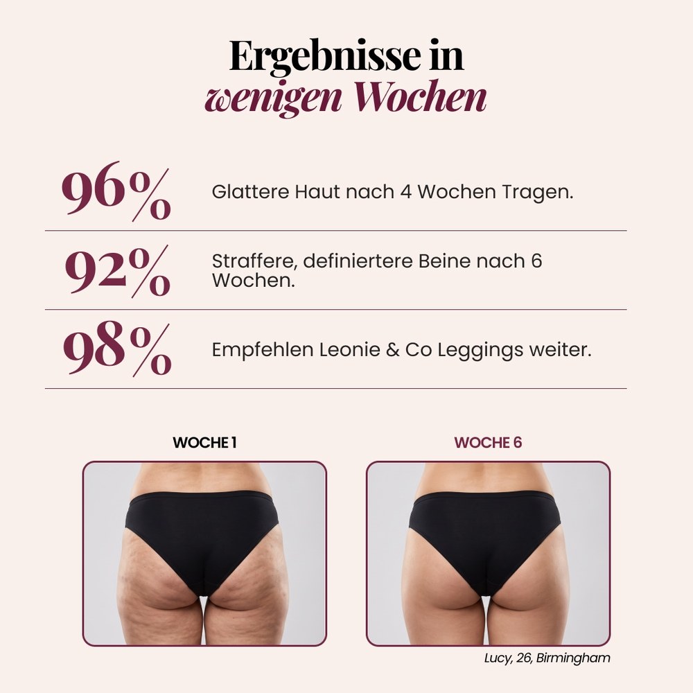 3D-Shorts | Schwarz