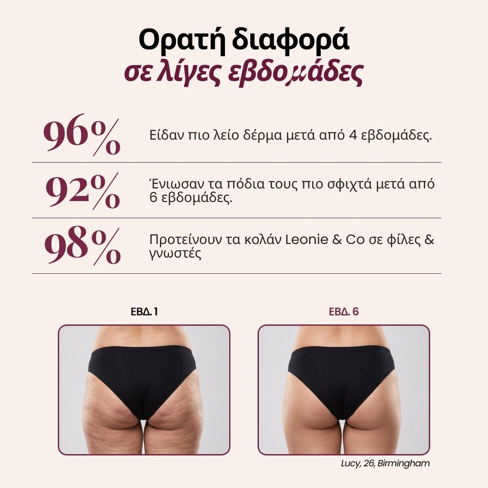 Σορτς 3D | Μαύρο