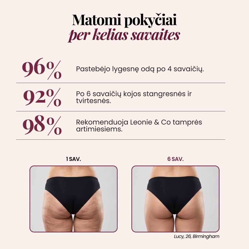 3D šortai | Juoda