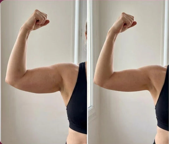 Before & After Emma (38 years old)