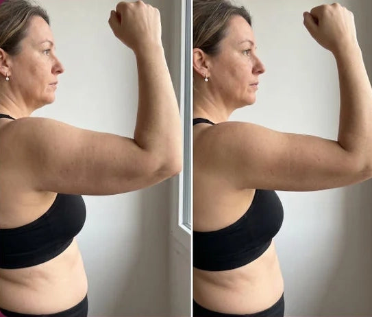 Bafore & After Claire (43 years old)