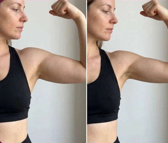 Before & After Hannah (31 years old)